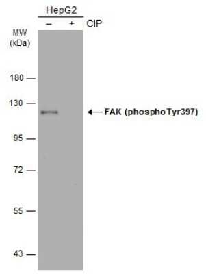 Western Blot: FAK [p Tyr397] Antibody [NBP3-12897]